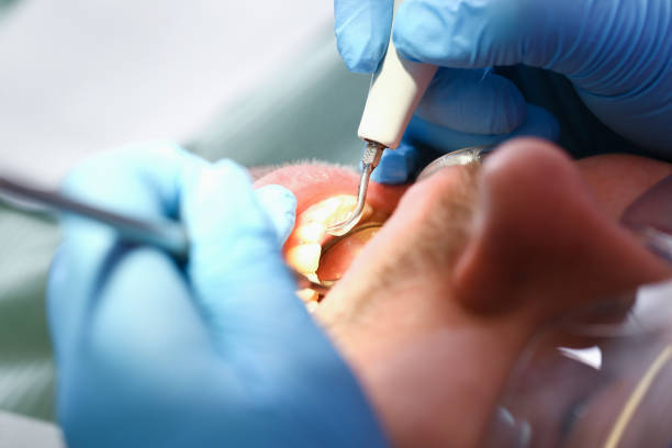 Best Same-Day Emergency Dental Services in Broadlands, VA