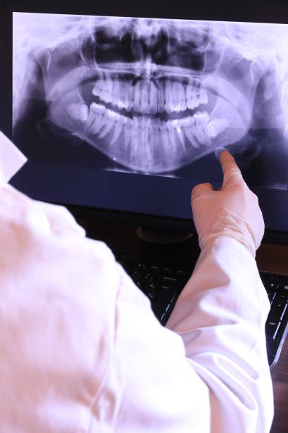 Best Emergency Wisdom Teeth Removal in Broadlands, VA