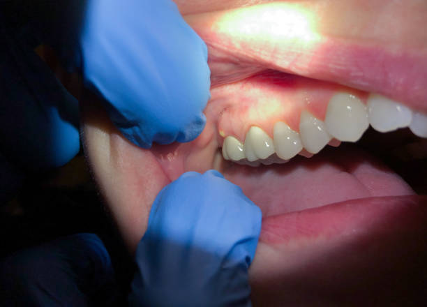 Best Emergency TMJ Treatment in Broadlands, VA